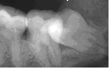 artebucal-cirugiaoral